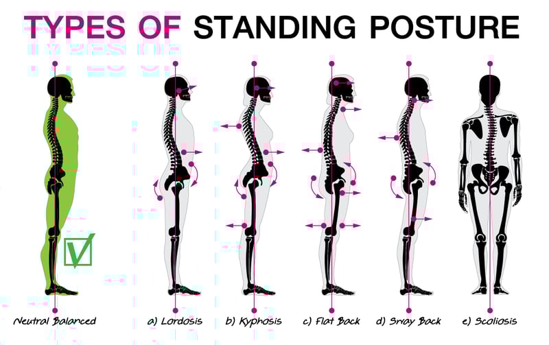 Types of standing posture