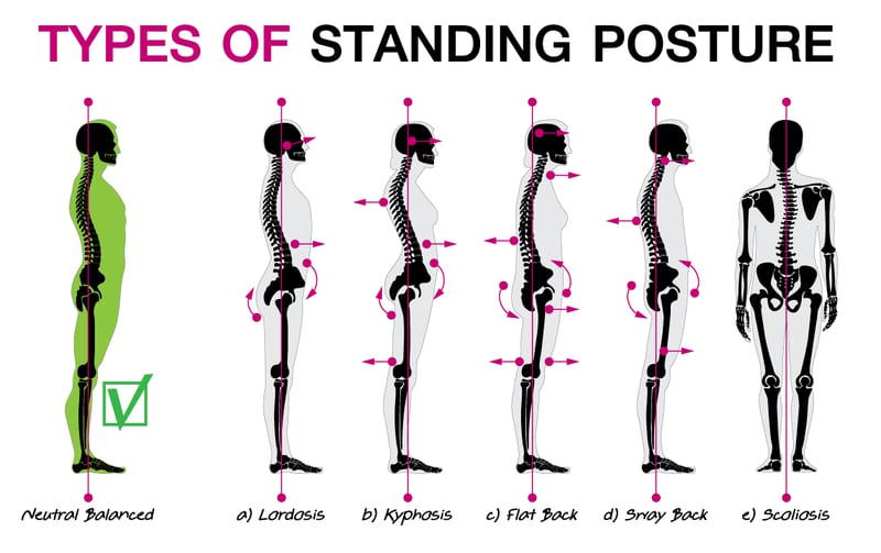 Types of standing posture