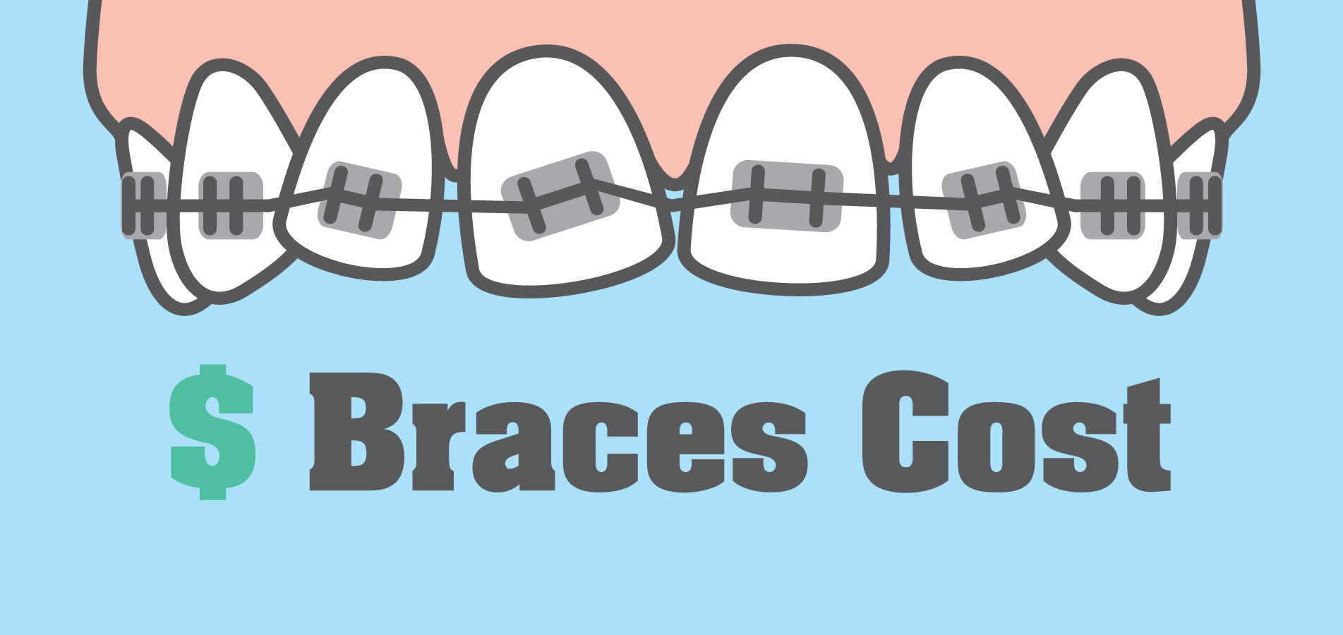 Price range and payment options for braces