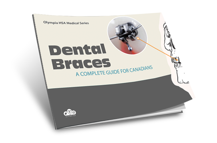 The Complete Guide to Dental Braces for Canadians