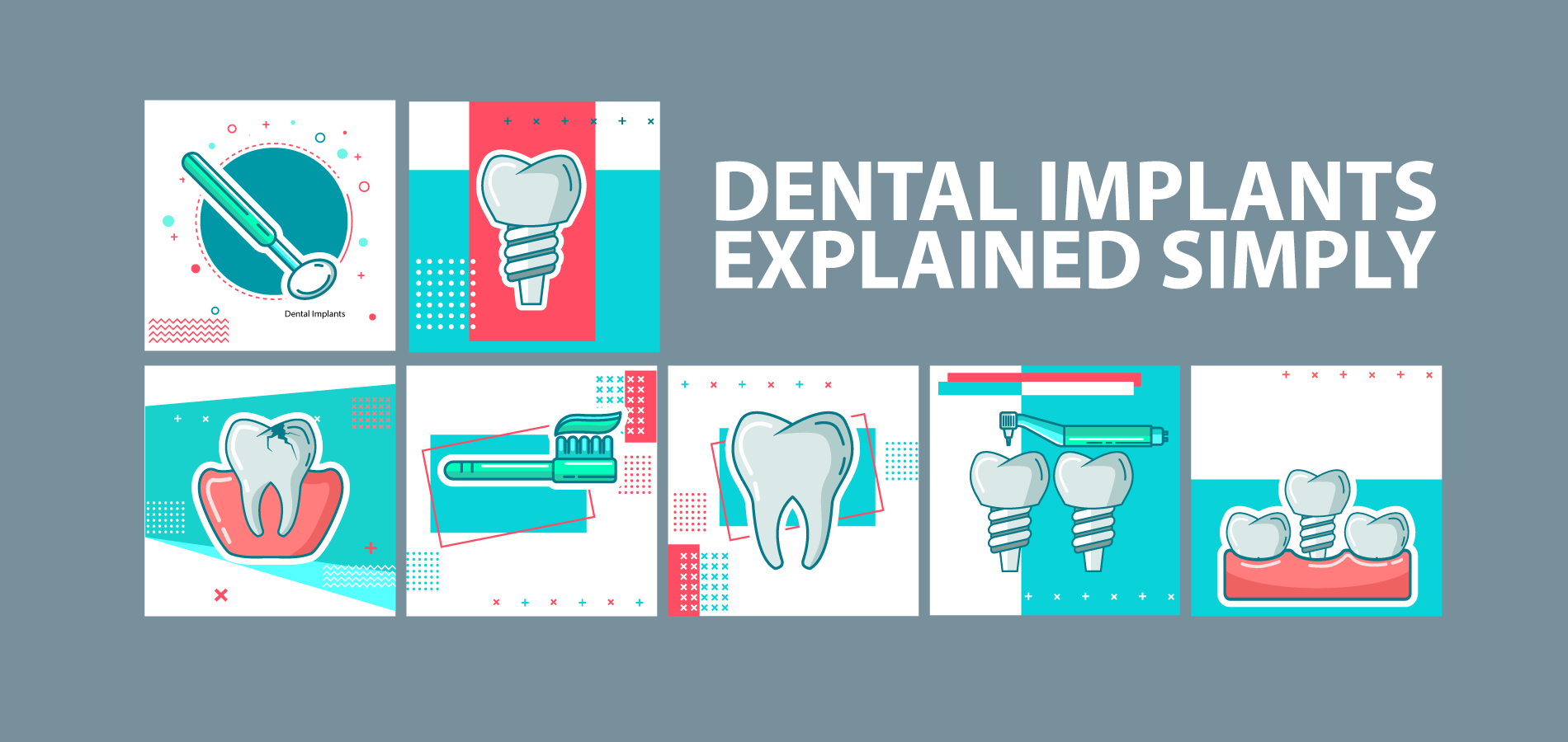 What is the cost of Dental Implants in Canada